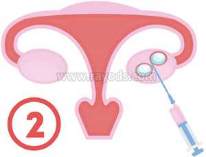 济南代生哪里安全，试管婴儿时需要宫颈细胞检查