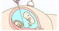 济南代生子的价格，做过泰国试管婴儿吗，成功率比例占比量多少？