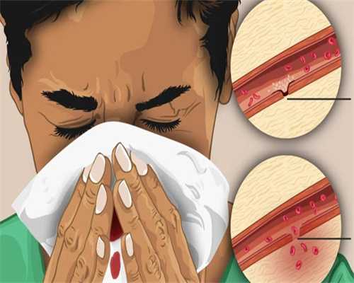 辅助生殖科普