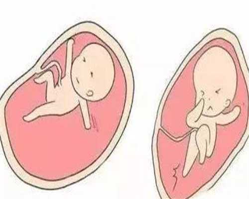 辅助生殖科普